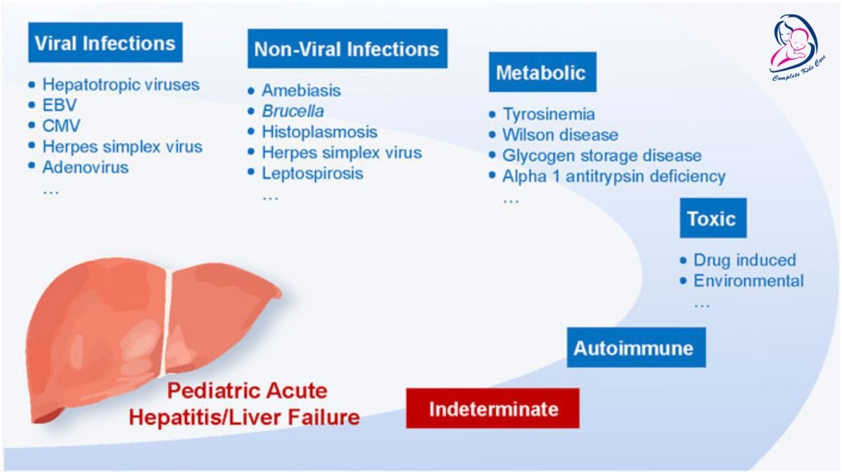 Hepatitis in kids by Dr Priyanka Jain - Child Specialist Doctor Near Me